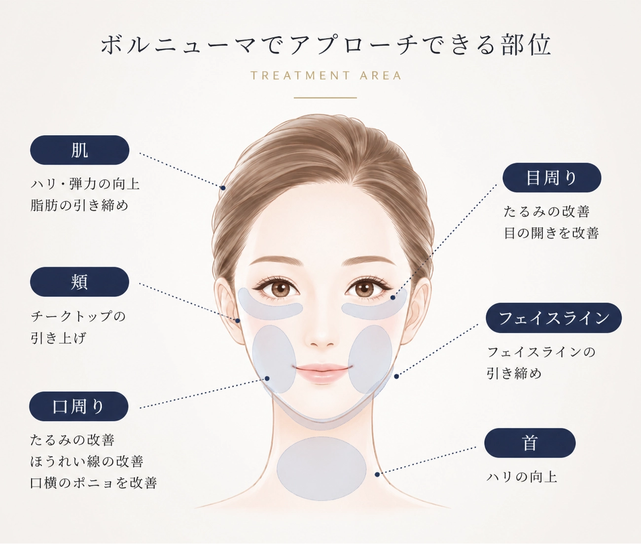 ボルニューマでアプローチできる部位