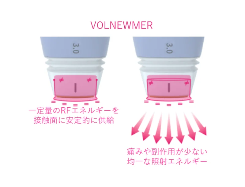 FR技術