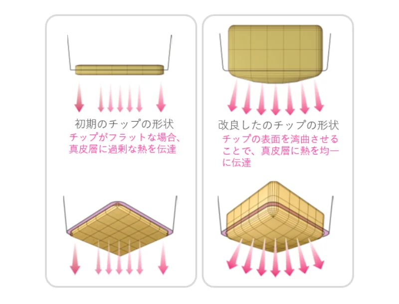チップの形状